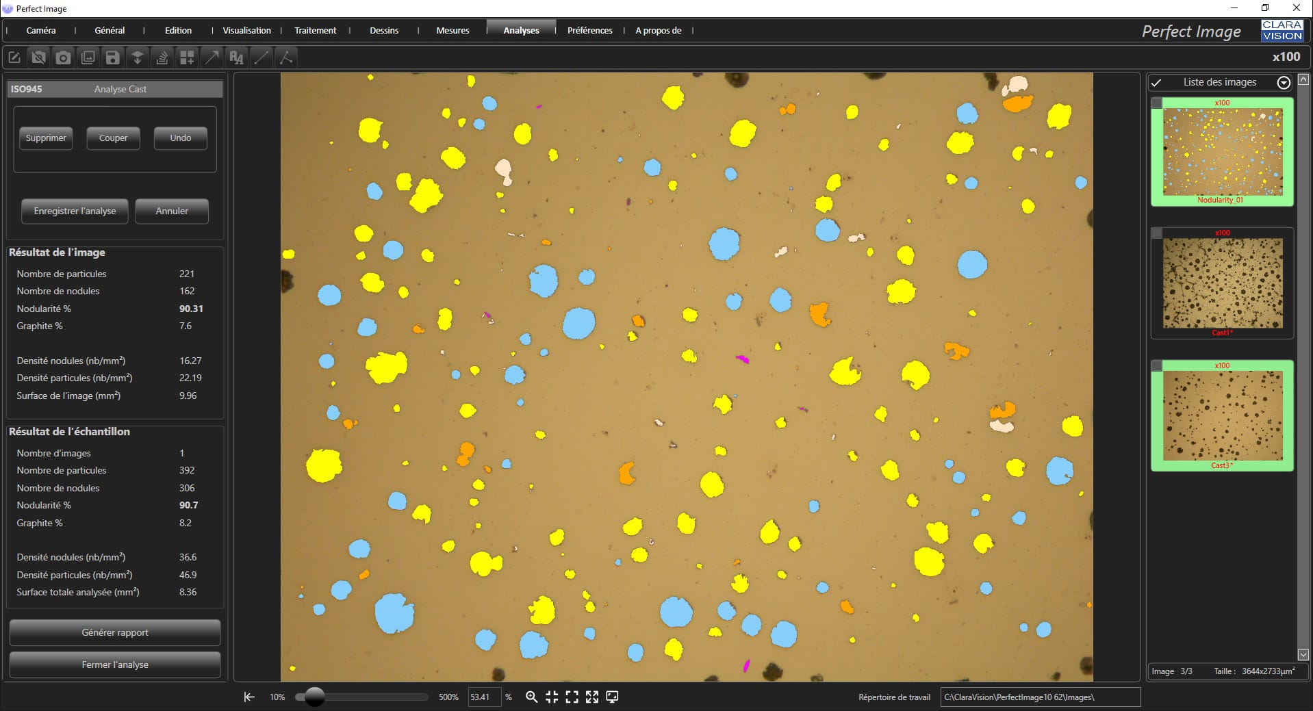Analyse des nodules de graphite en métallographie